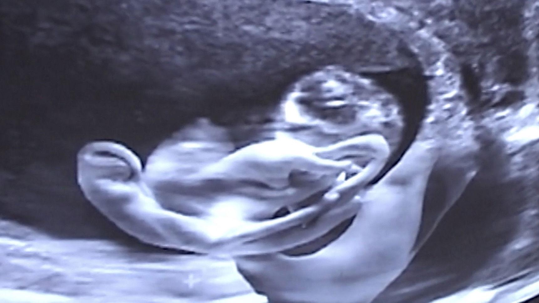 Castration Movie Anthology iii. Year of the Hyaena