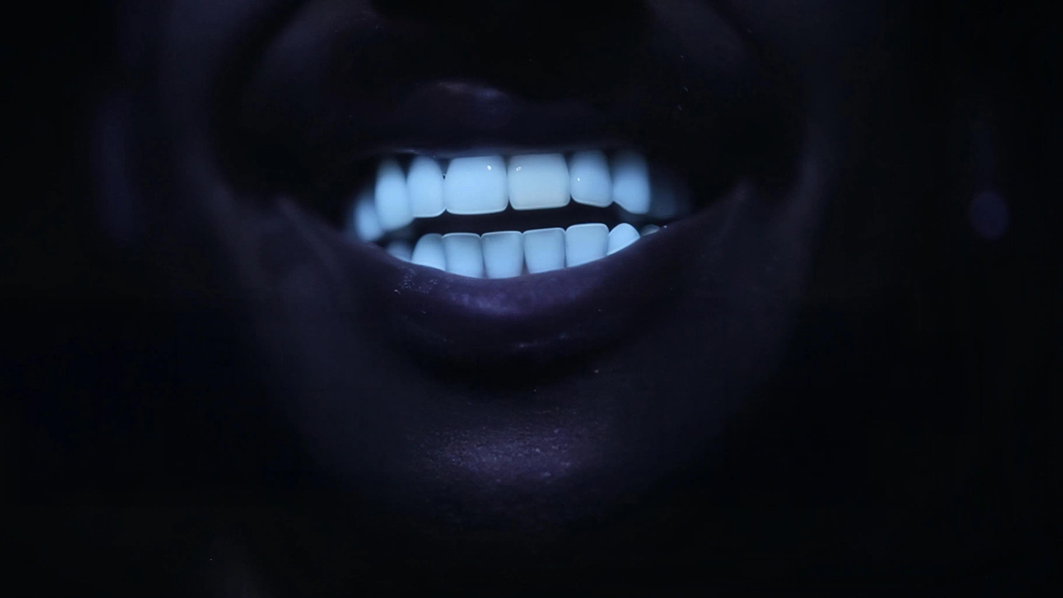 Des dents blanches... au rire jaune !