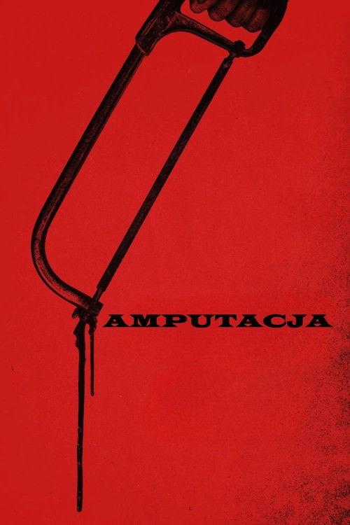 Amputacja